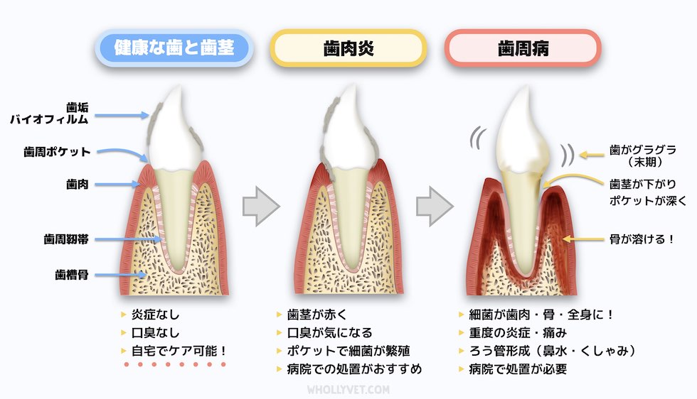 コレクション 歯周病菌は食器を洗っても感染するの